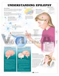 Understanding Epilepsy Anatomical Chart